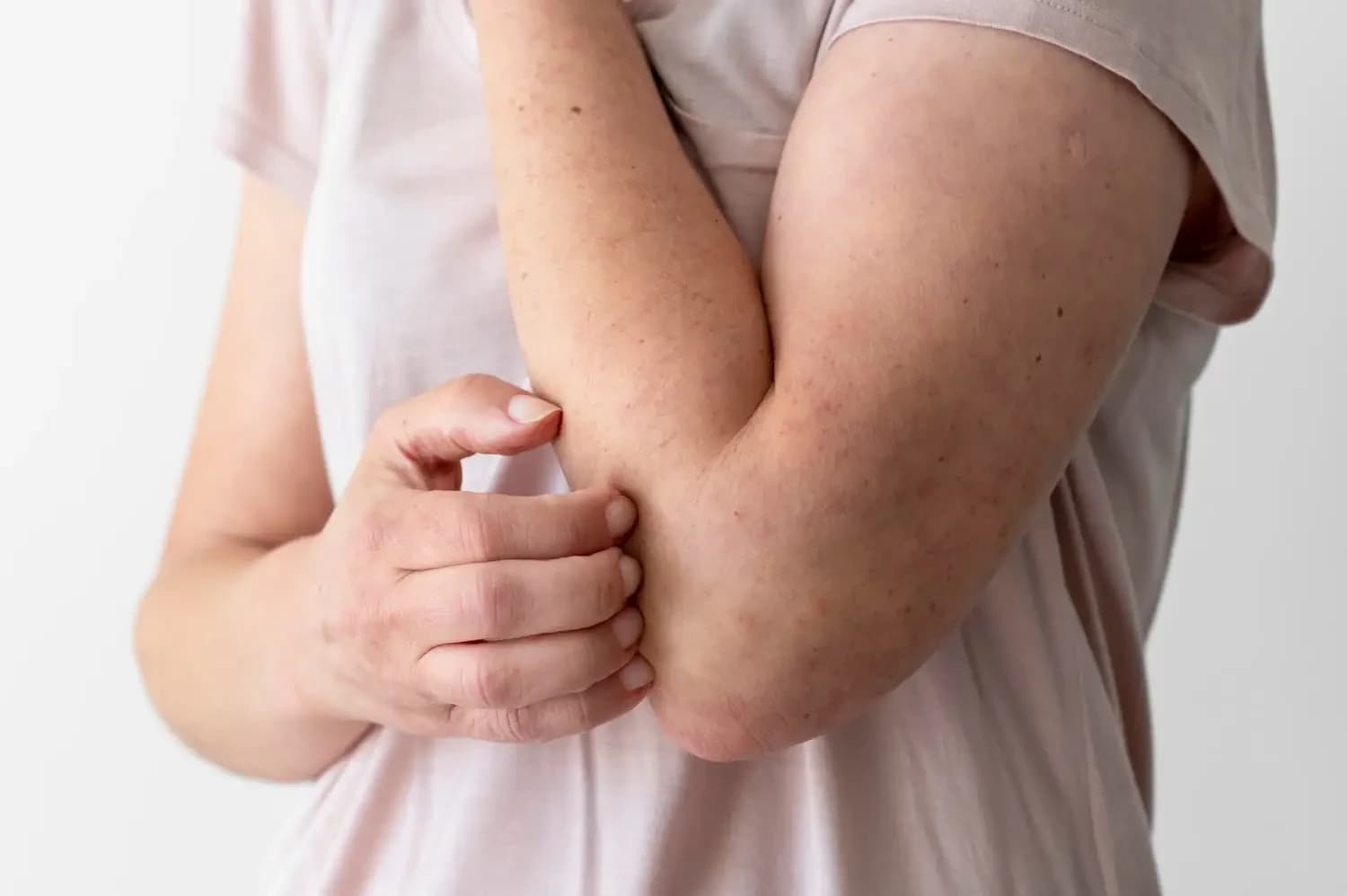 $81M Injection Fuels Elion's Quest for Antifungal Therapy Advancement