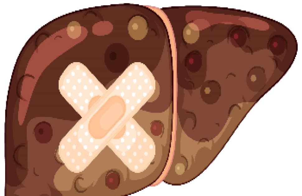 Boehringer Ingelheim joins forces with Ochre Bio to fight liver disease together