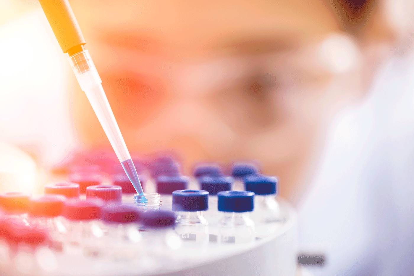 Evotec and Pfizer Unite For Revolutionary Drug Innovations In French Labs