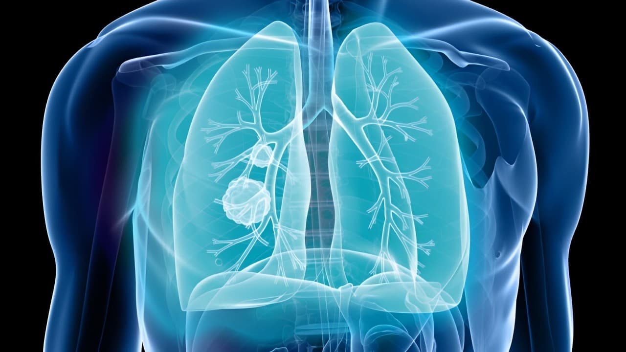 Enhertu Receives Conditional Approval for HER2-Mutant Lung Cancer in China