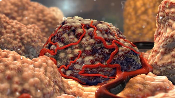 BioAtla Announces $9.2M Fundraising To Advance Tumor Therapies