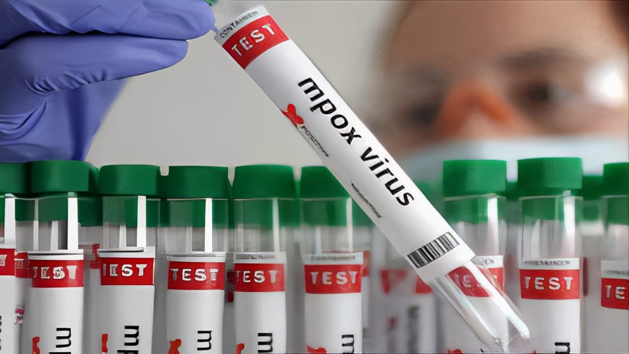 WHO Approves First Mpox Diagnostic Test Under Emergency Use Listing