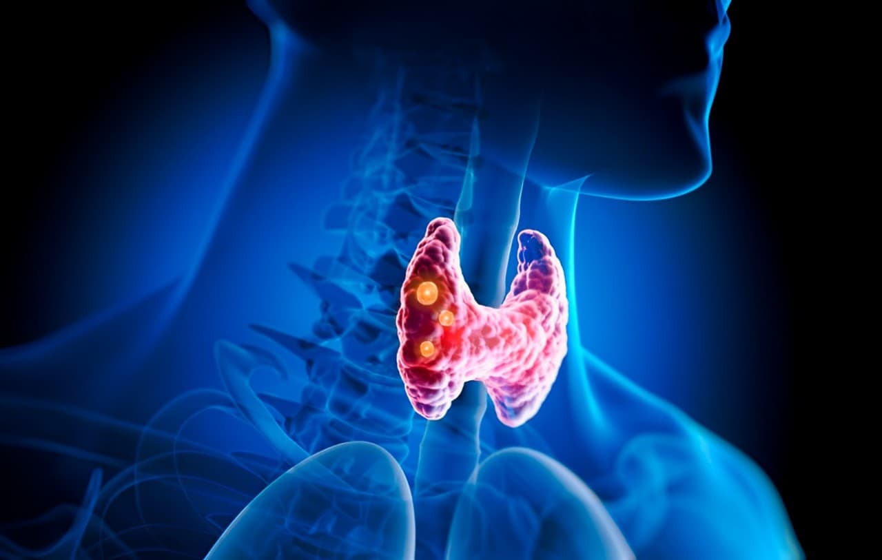 YORVIPATH Revolutionizes Hypoparathyroidism Treatment
