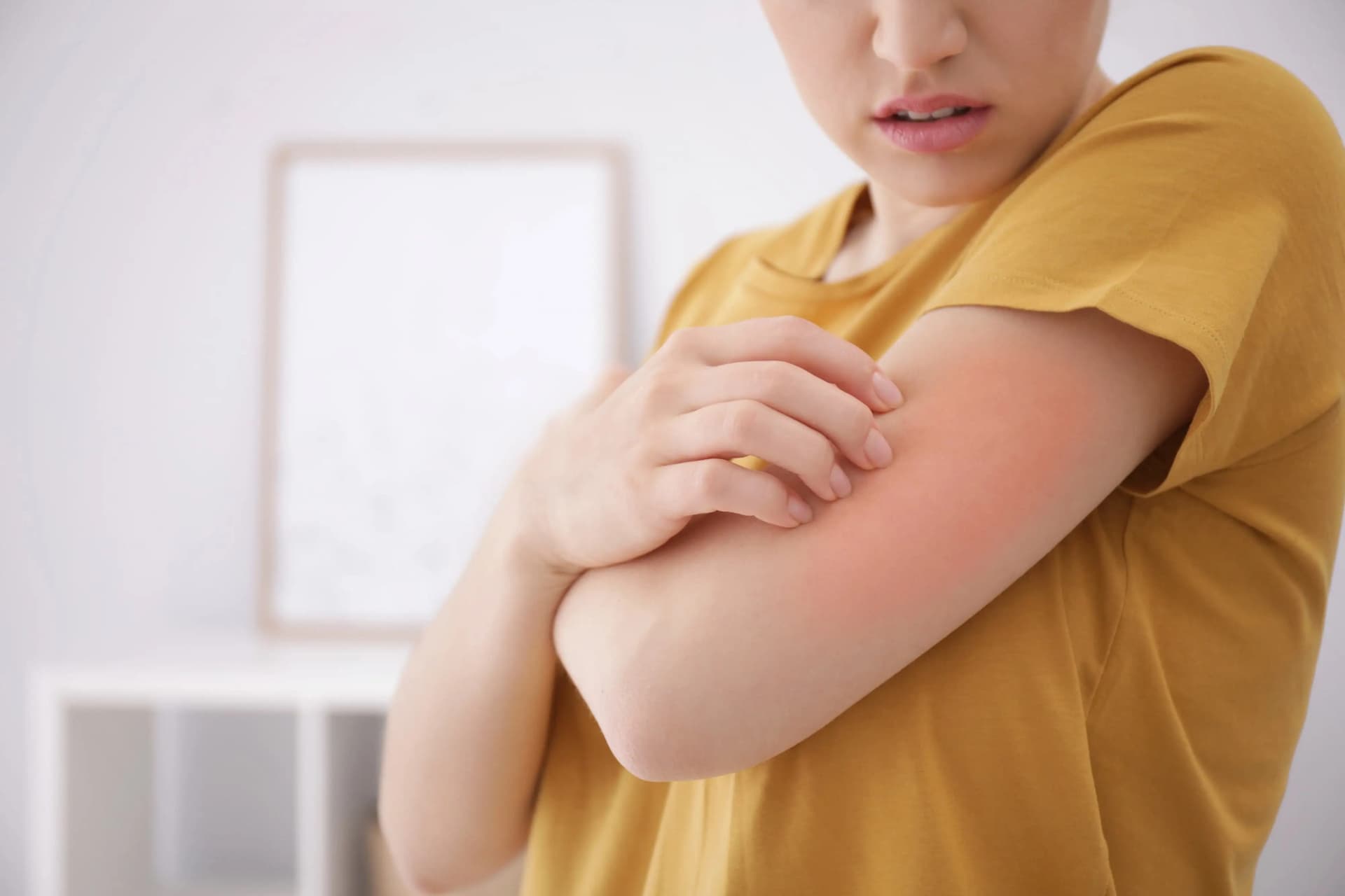 Celldex's Barzolvolimab Phase 2 Study Delivers Positive News For Chronic Inducible Urticaria Patients
