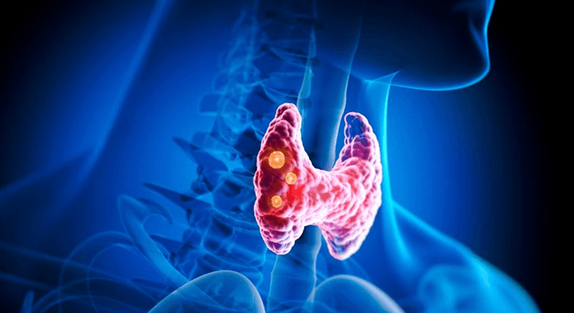 FDA Signals Enforcement Shift on Unapproved Desiccated Thyroid Extract Products Used by 1.5 Million Patients